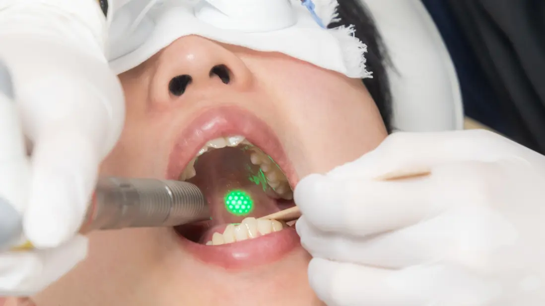 パルスサーミア施術イメージ