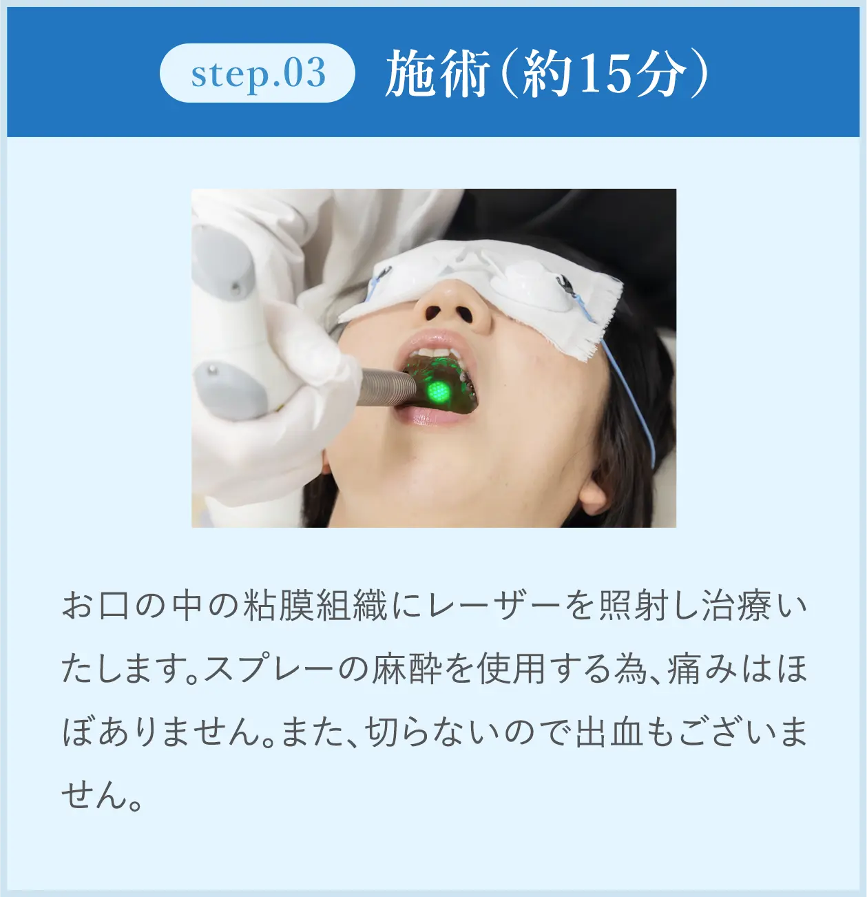 step03 施術(約15分)