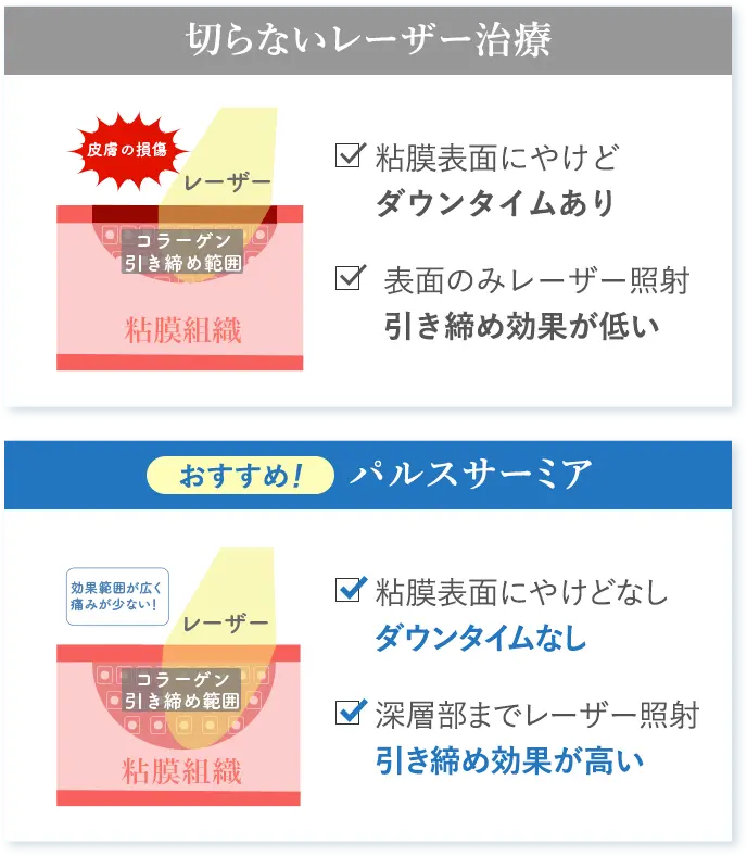 切らないレーザー治療とパルスサーミアの比較