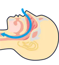 気道が正常な状態の人体の図
