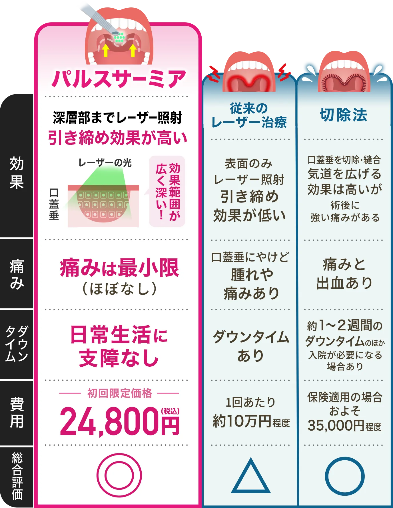 従来のレーザー治療・切除法・パルスサーミアの比較表