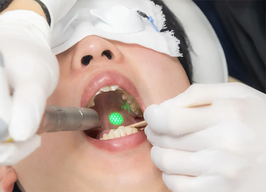 パルスサーミア施術イメージ