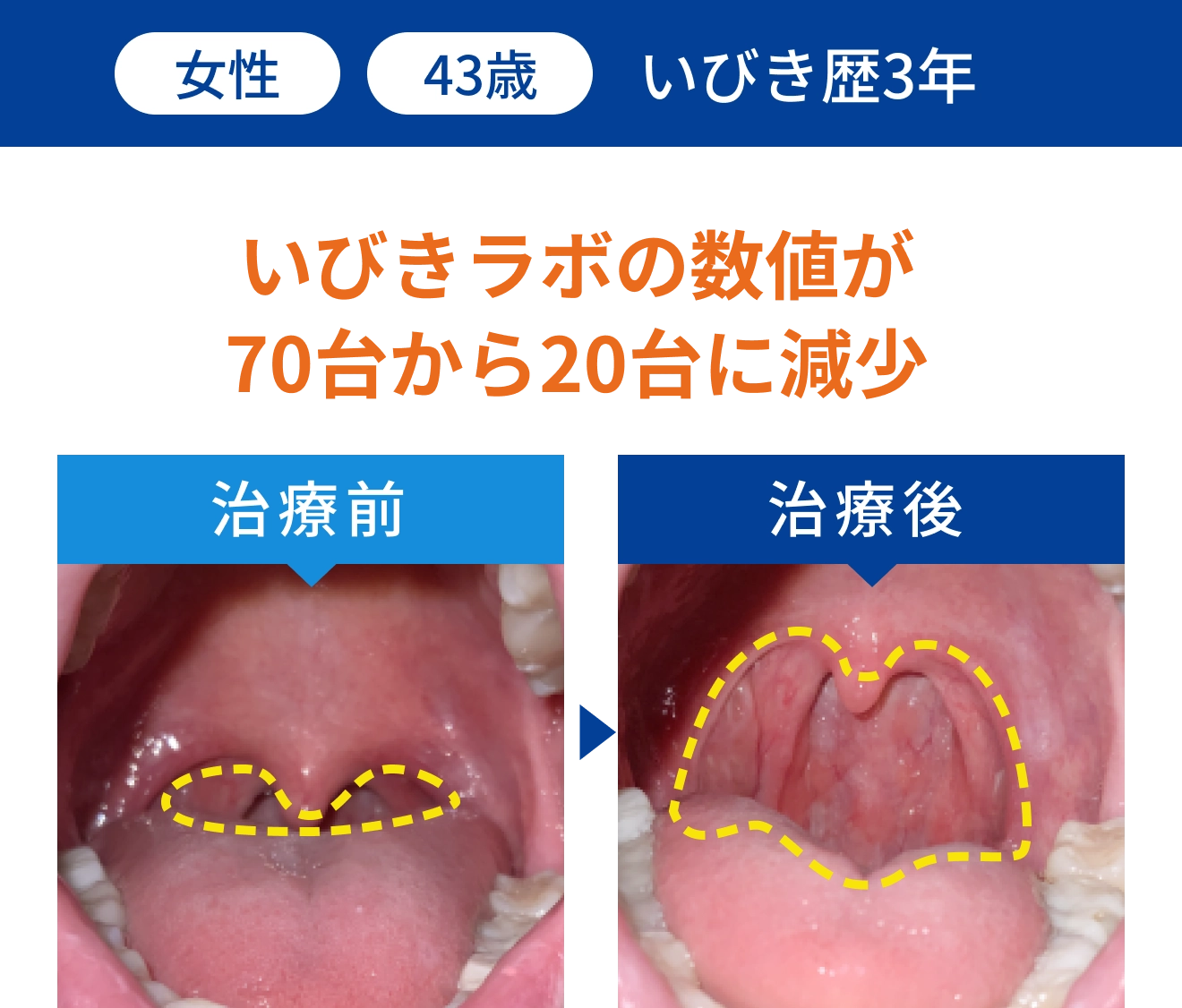 症例 3: 改善データ