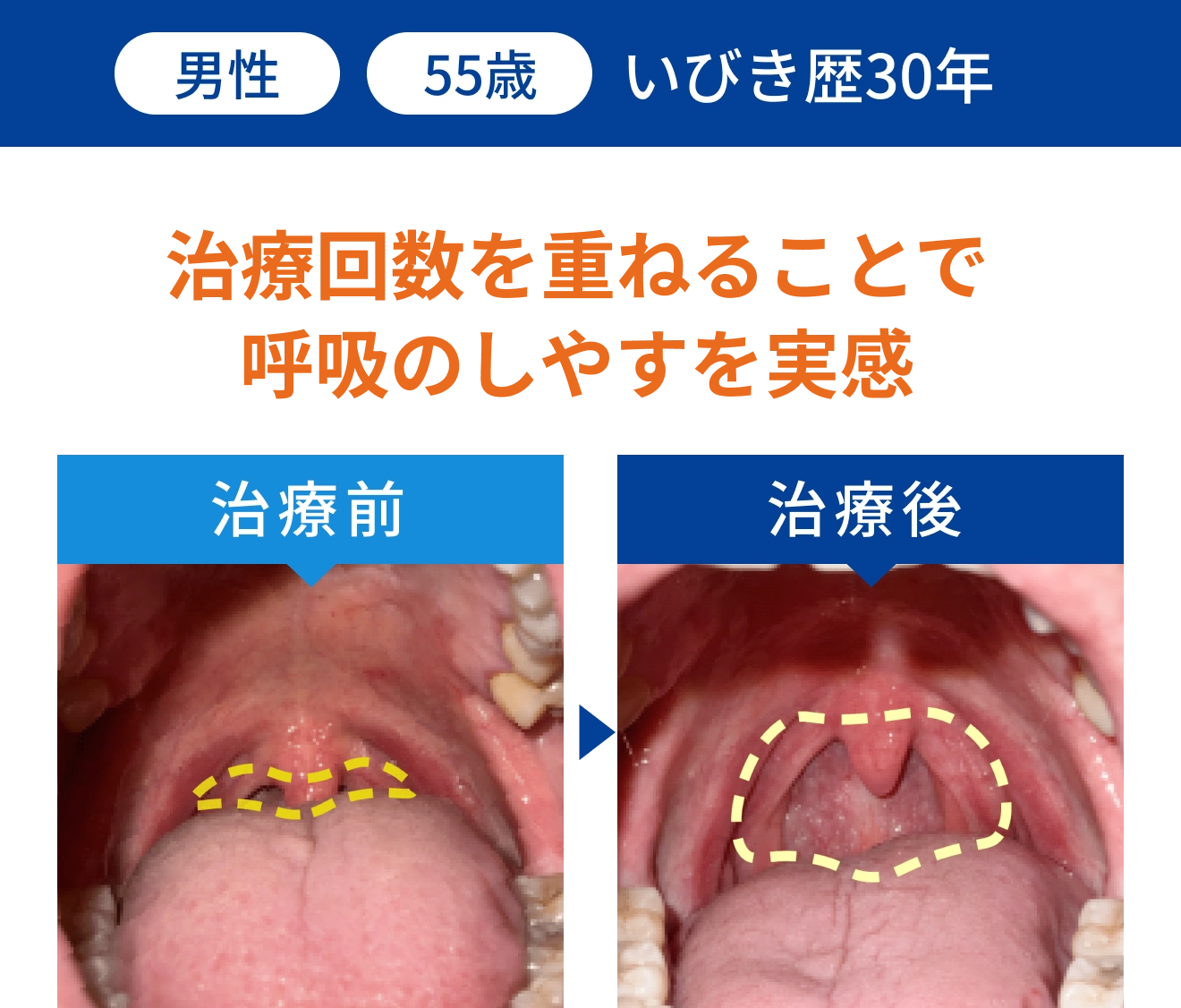 症例 4: 改善データ