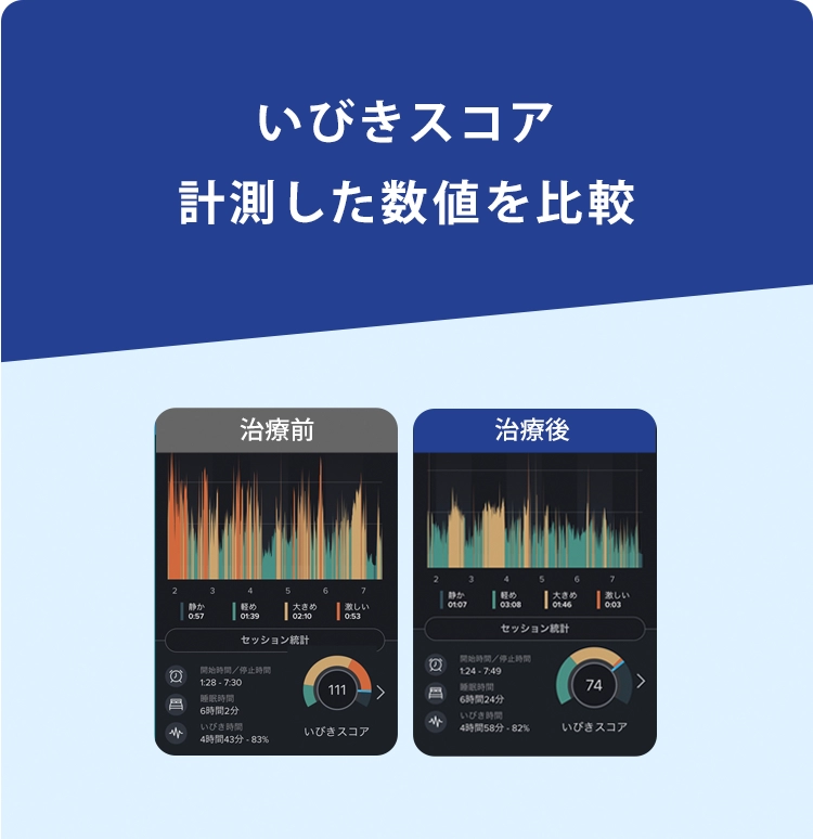 いびきスコアを計測、治療前と治療後の改善数値を見る