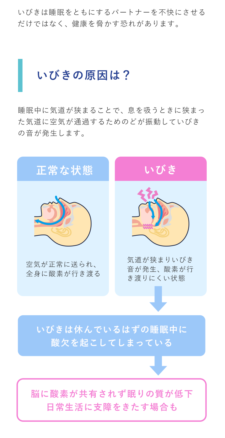 いびきは睡眠をともにするパートナーを不快にさせるだけではなく、健康を脅かす恐れがあります。いびきの原因は？睡眠中に気道が狭まることで、息を吸うときに狭まった気道に空気が通過するためのどが振動していびきの音が発生します。