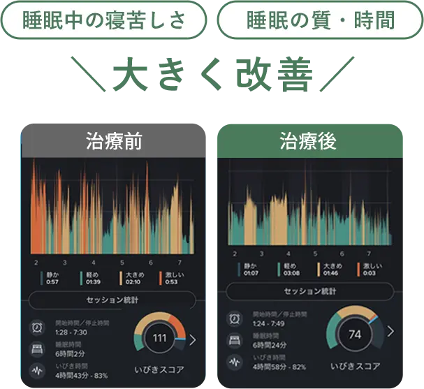 睡眠中の苦しさや質が大きく改善した結果のグラフ