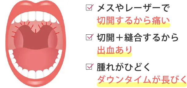 切らないから痛くない出血なし×ダウンタイムほぼなし