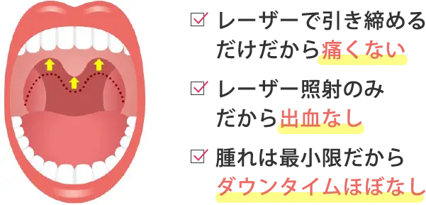 切らないから痛くない出血なし×ダウンタイムほぼなし