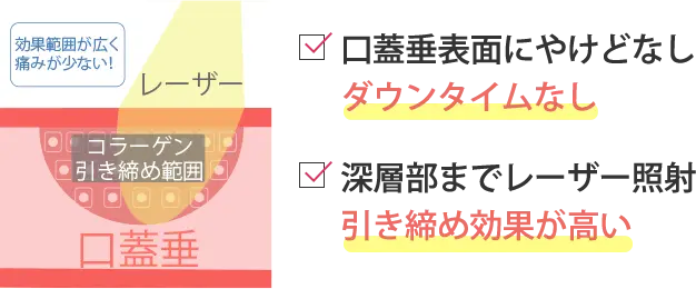 切らないから痛くない出血なし×ダウンタイムほぼなし