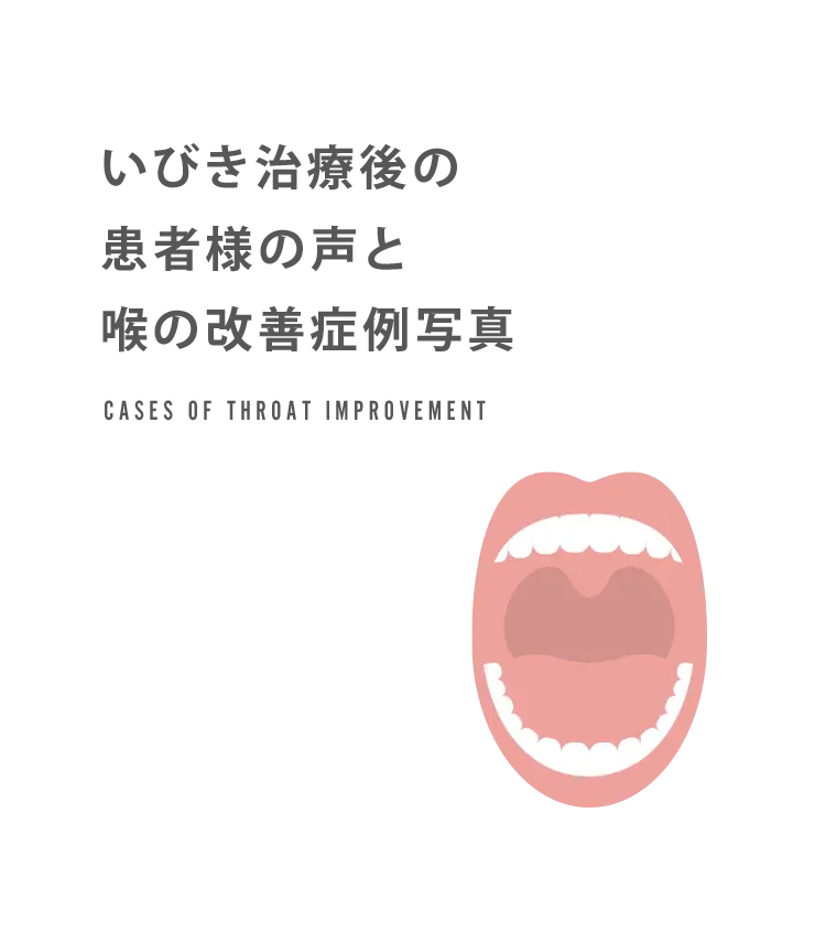 いびき治療後の患者様の声と喉の改善症例を見る