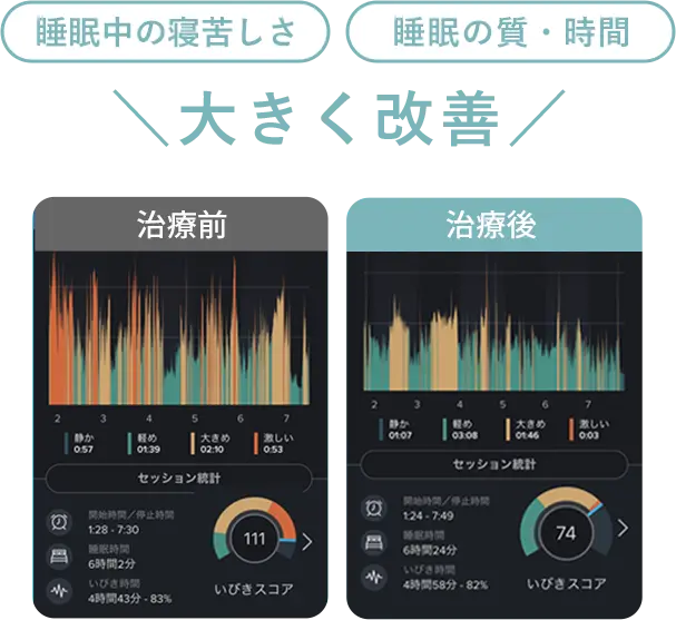 睡眠中の苦しさや質が大きく改善した結果のグラフ
