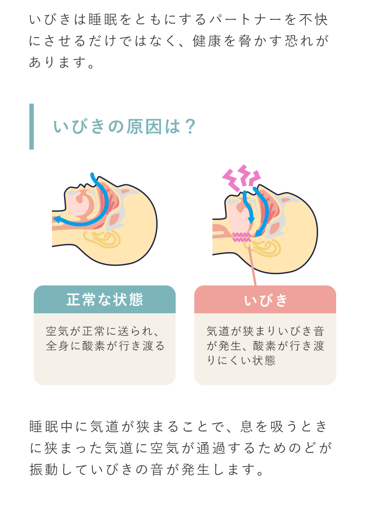 いびきは睡眠をともにするパートナーを不快にさせるだけではなく、健康を脅かす恐れがあります。いびきの原因は？睡眠中に気道が狭まることで、息を吸うときに狭まった気道に空気が通過するためのどが振動していびきの音が発生します。