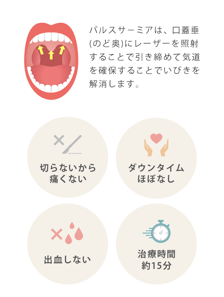 パルスサーミアは、口蓋垂(のど奥)にレーザーを照射することで引き締めて気道を確保します。パルスサ－ミアは、CPAPやマウスピースのような対症治療ではなくいびきの原因を根本から治療します。切らないから痛くない　ダウンタイムほぼなし　出血しない　治療時間約15分