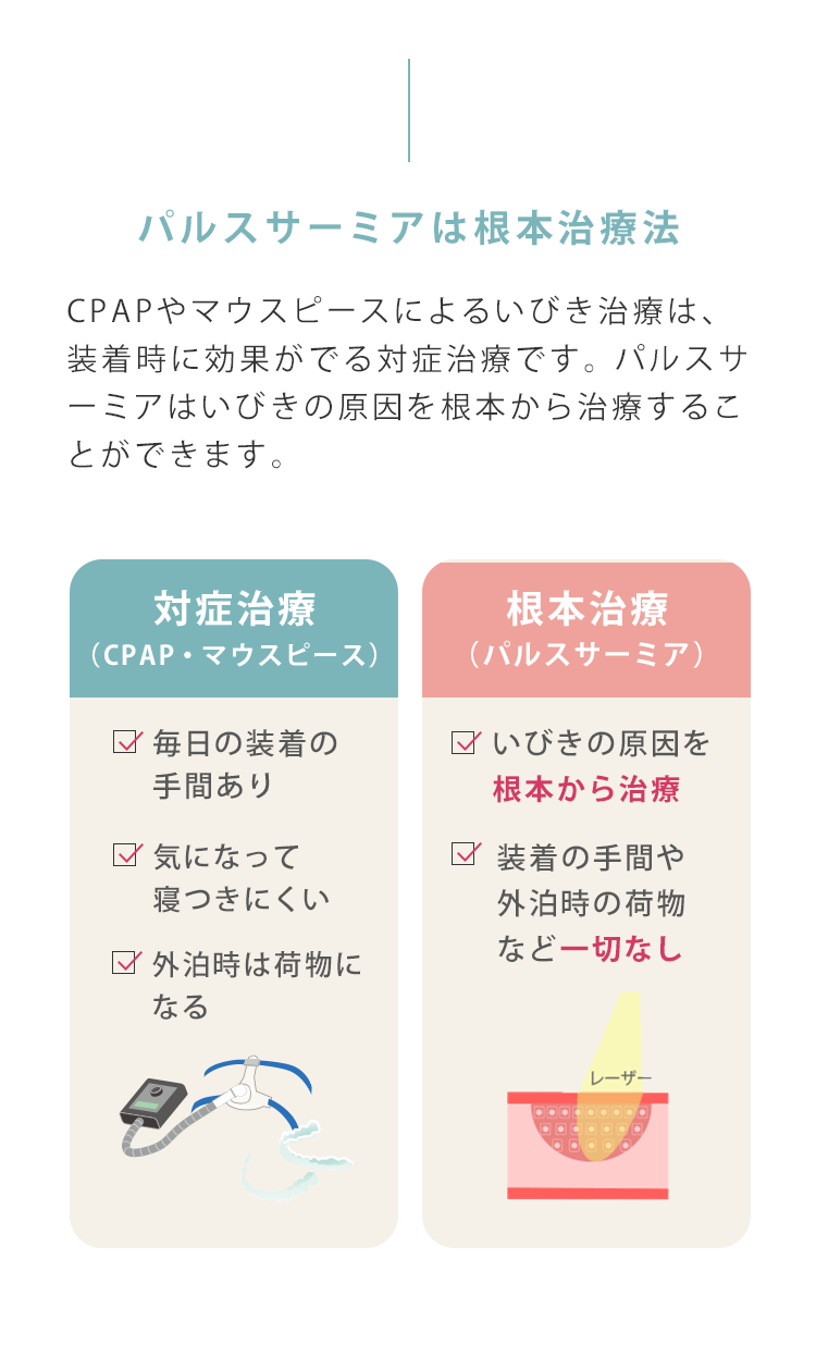 パルスサーミアは、口蓋垂(のど奥)にレーザーを照射することで引き締めて気道を確保します。パルスサ－ミアは、CPAPやマウスピースのような対症治療ではなくいびきの原因を根本から治療します。切らないから痛くない　ダウンタイムほぼなし　出血しない　治療時間約15分