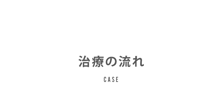 治療の流れ