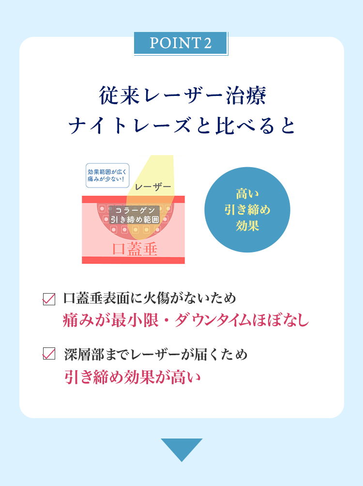 POINT02 従来レーザー(ナイトレーズ)と比べると　口蓋垂表面に火傷がないため痛みが最小限・ダウンタイムほぼなし　深層部までレーザーが届くため引き締め効果が高い