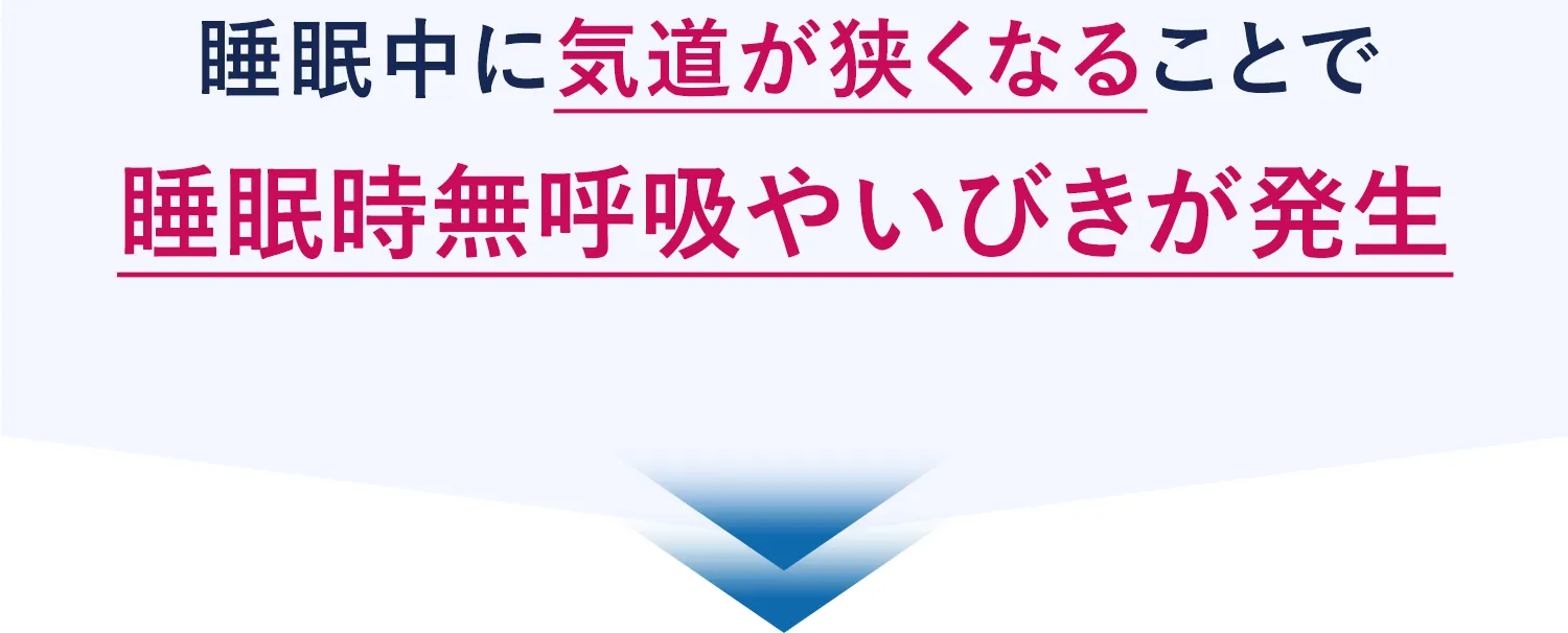 睡眠中に気道が狭まくなることで睡眠時無呼吸やいびきが発生
