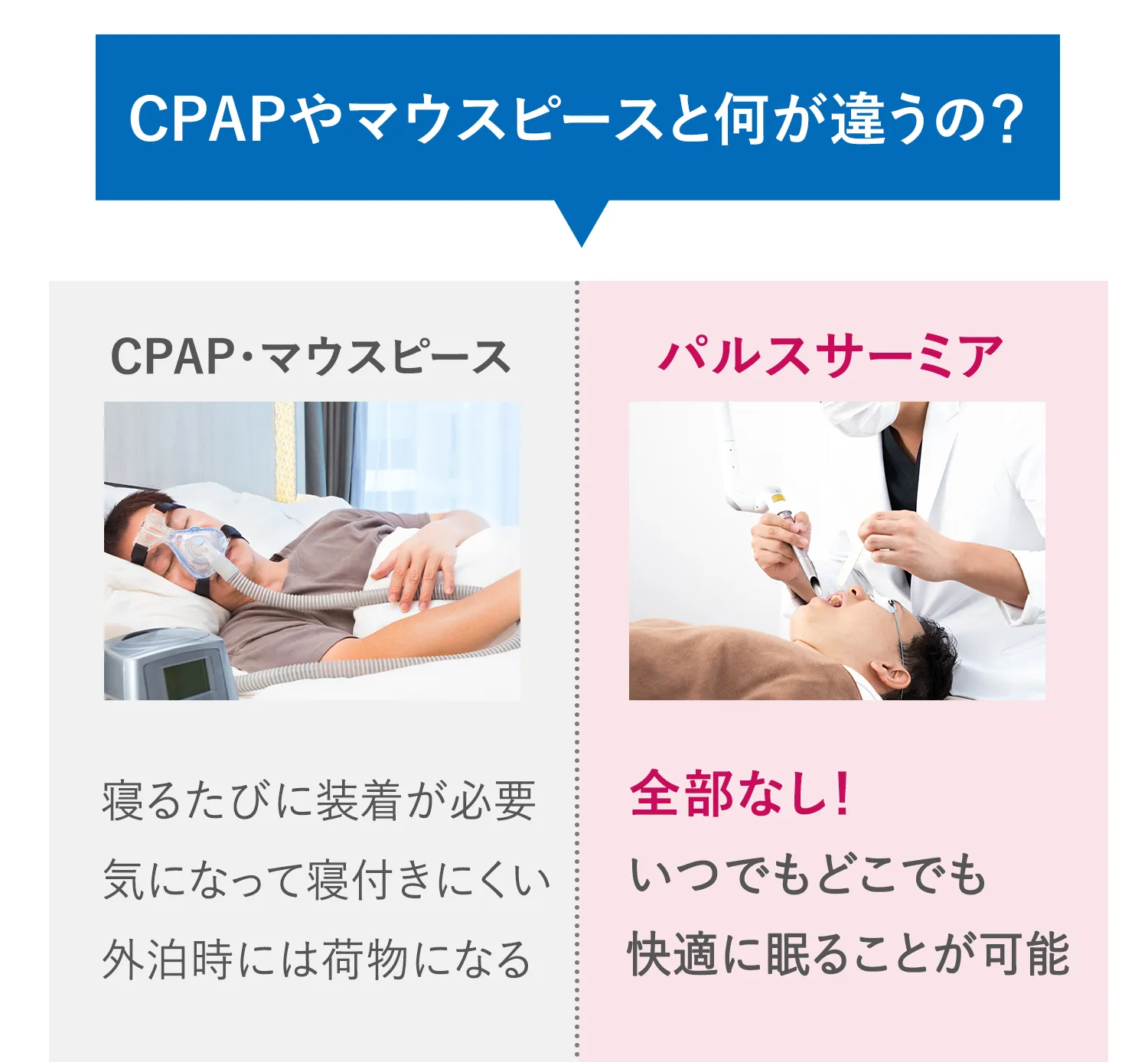 CPAPやマウスピースと何が違うの？
