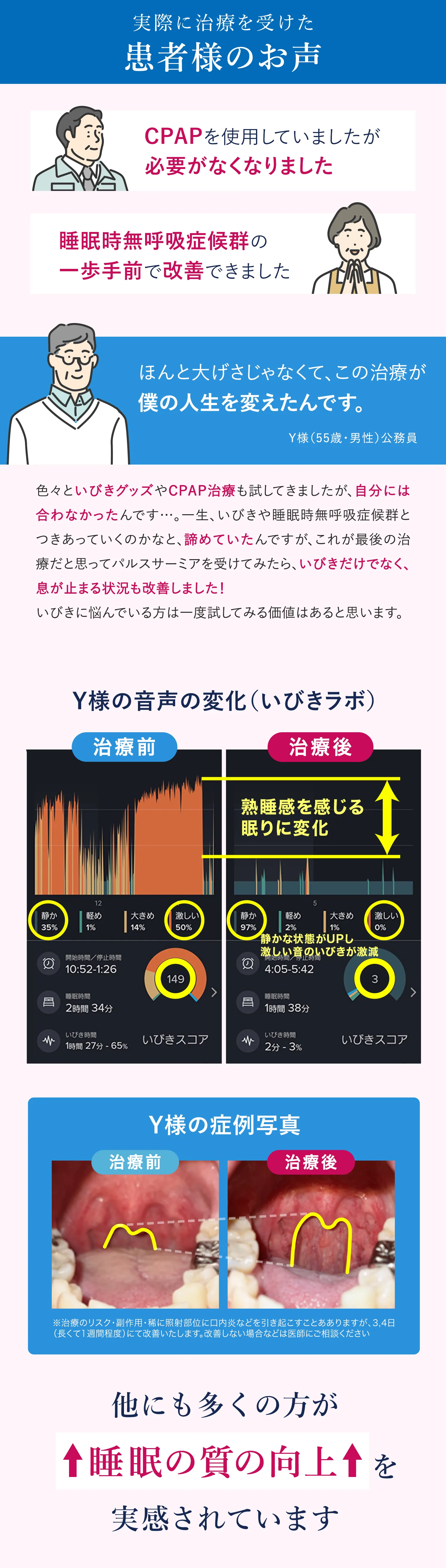 実際に治療を受けた患者様のお声 患者様の音声の変化（いびきラボ）患者様の症例写真 他にも多くの方が睡眠の質の向上を実感されています