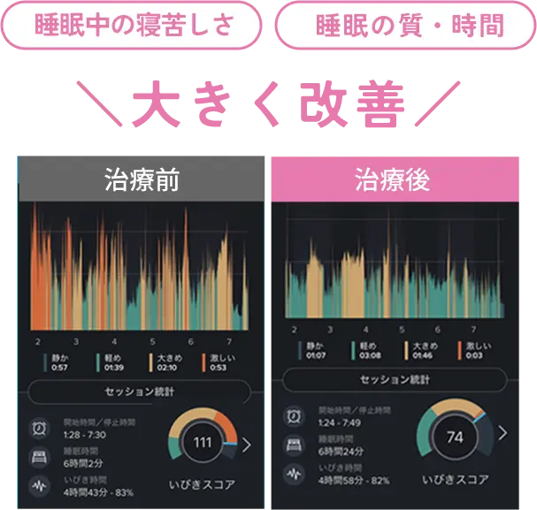 睡眠中の苦しさや質が大きく改善した結果のグラフ