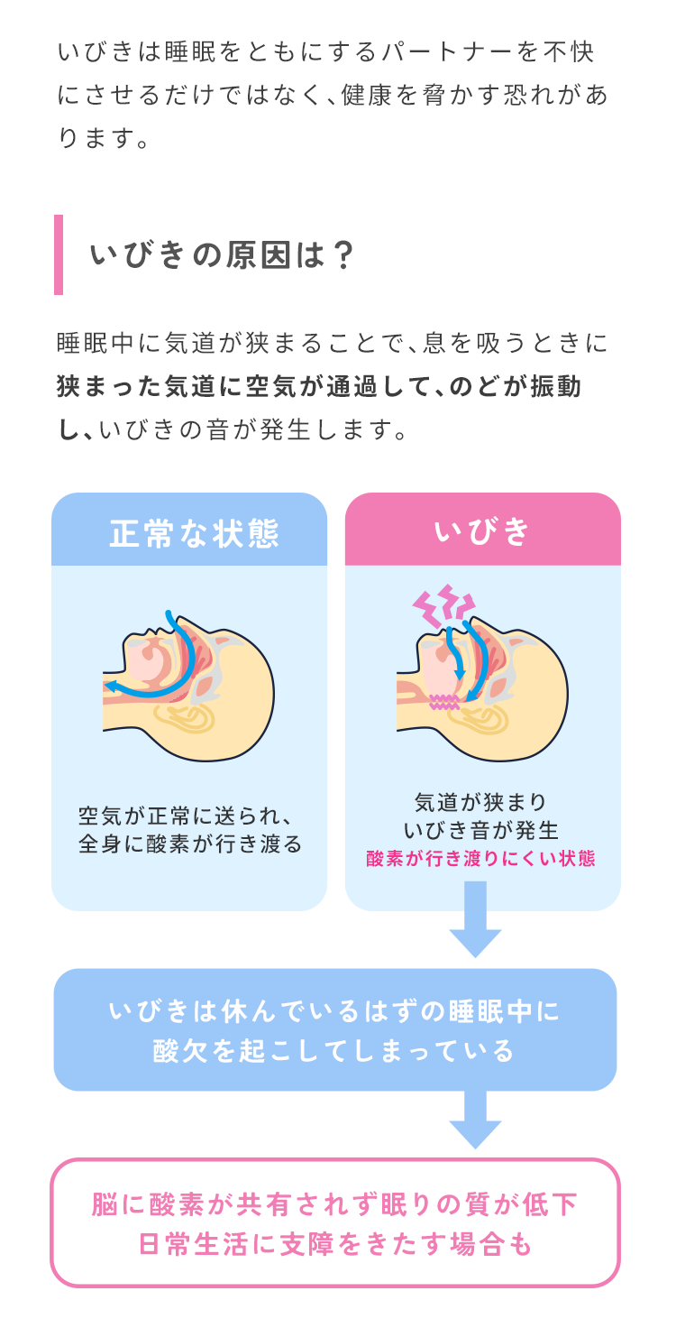 いびきは睡眠をともにするパートナーを不快にさせるだけではなく、健康を脅かす恐れがあります。いびきの原因は？睡眠中に気道が狭まることで、息を吸うときに狭まった気道に空気が通過するためのどが振動していびきの音が発生します。