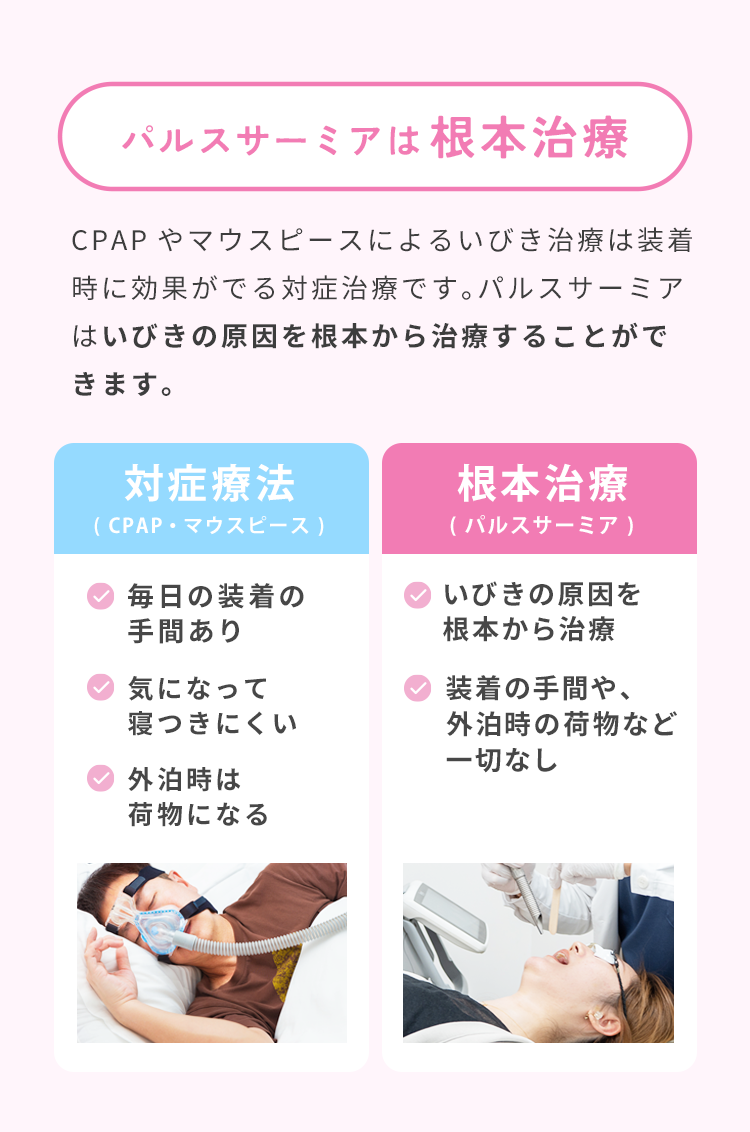 パルスサーミアは、口蓋垂(のど奥)にレーザーを照射することで引き締めて気道を確保します。パルスサ－ミアは、CPAPやマウスピースのような対症治療ではなくいびきの原因を根本から治療します。切らないから痛くない　ダウンタイムほぼなし　出血しない　治療時間約15分