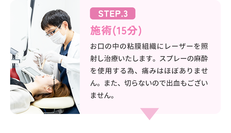 STEP.3 施術（15分） お口の中の粘膜組織にレーザーを照射し治療いたします。スプレーの麻酔を使用する為、痛みはほぼありません。また、切らないので出血もございません。