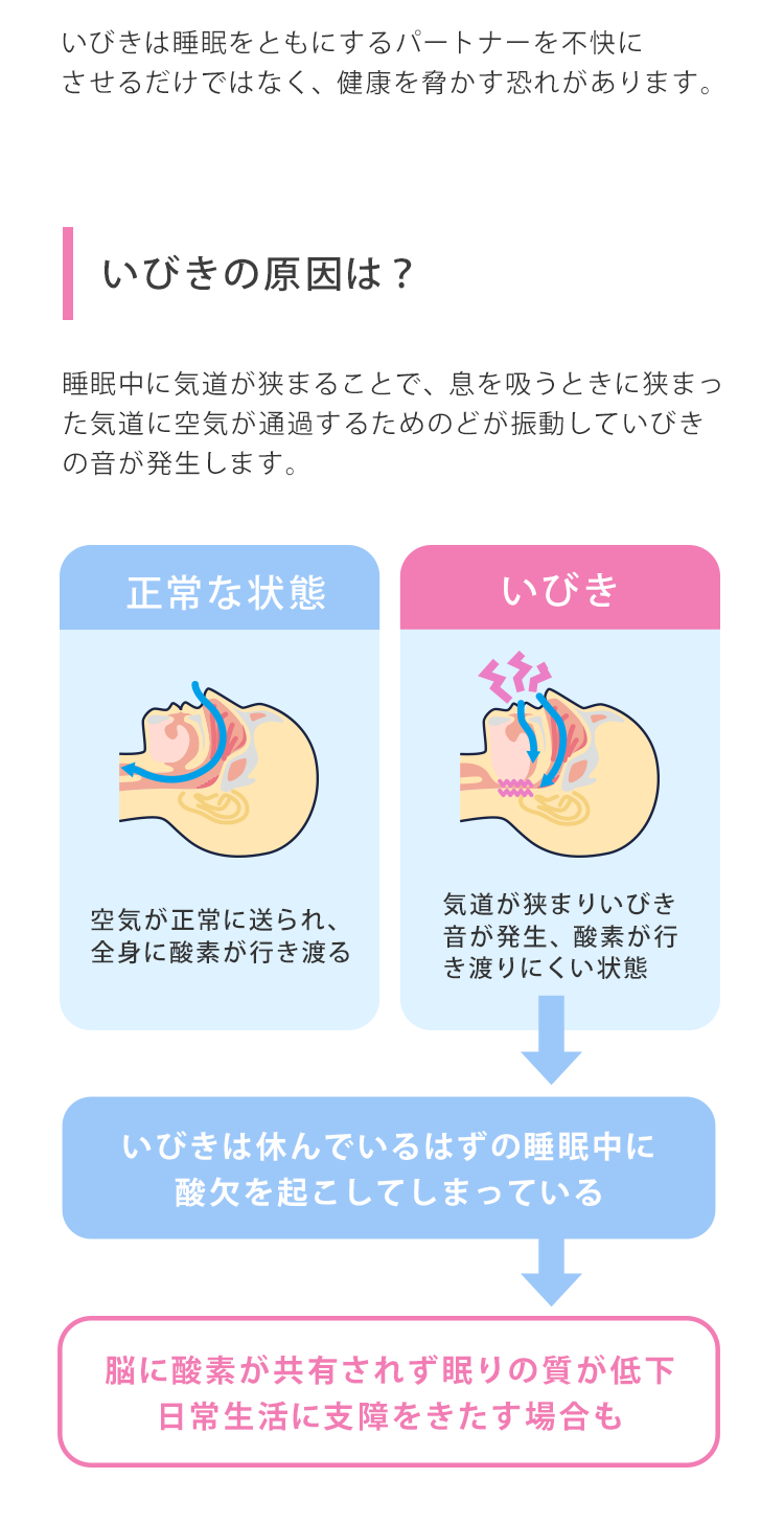 いびきは睡眠をともにするパートナーを不快にさせるだけではなく、健康を脅かす恐れがあります。いびきの原因は？睡眠中に気道が狭まることで、息を吸うときに狭まった気道に空気が通過するためのどが振動していびきの音が発生します。
