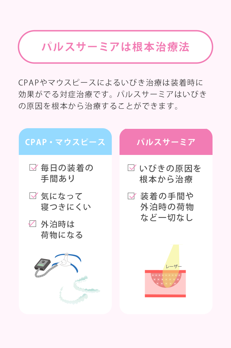 パルスサーミアは、口蓋垂(のど奥)にレーザーを照射することで引き締めて気道を確保します。パルスサ－ミアは、CPAPやマウスピースのような対症治療ではなくいびきの原因を根本から治療します。切らないから痛くない　ダウンタイムほぼなし　出血しない　治療時間約15分