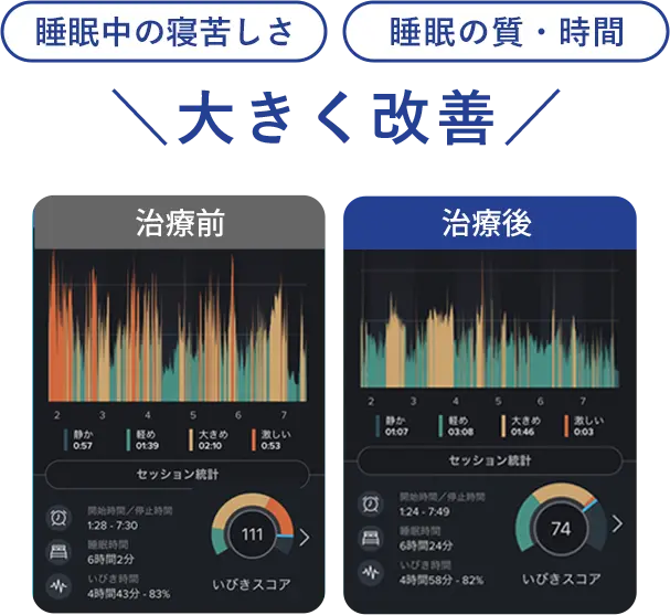 睡眠中の苦しさや質が大きく改善した結果のグラフ