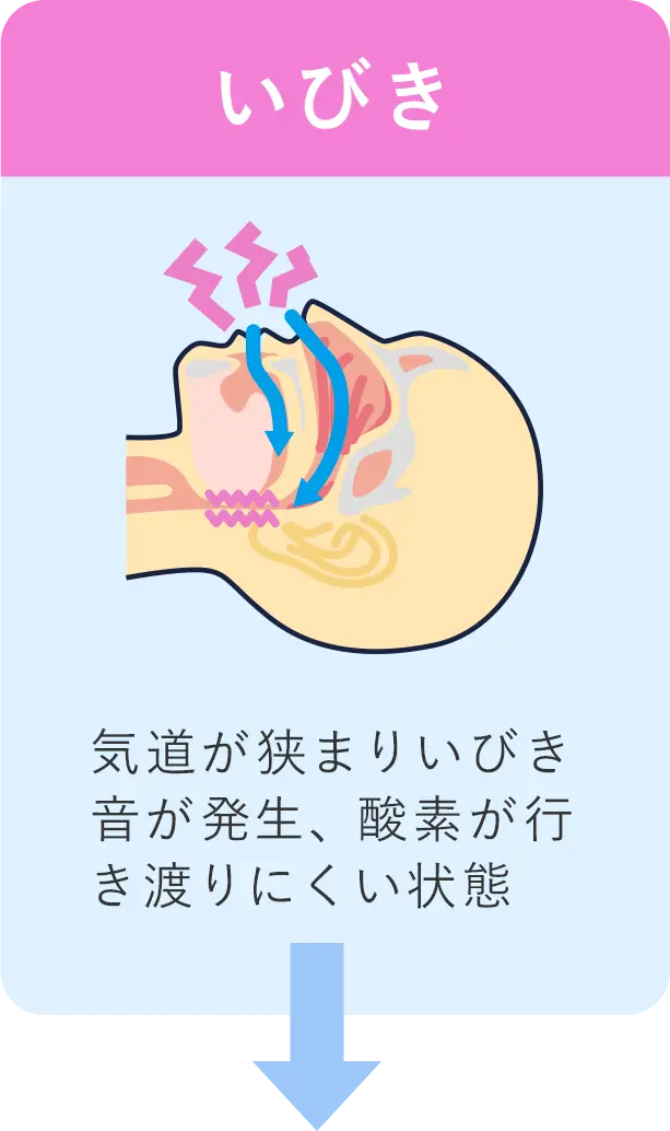いびき/気道が狭まりいびき音が発生、酸素が行き渡りにくい状態