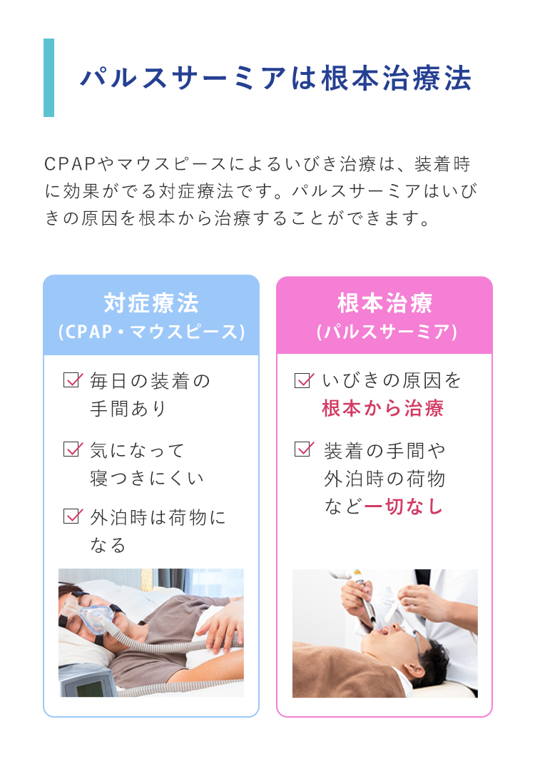 パルスサーミアは、口蓋垂(のど奥)にレーザーを照射することで引き締めて気道を確保します。パルスサ－ミアは、CPAPやマウスピースのような対症治療ではなくいびきの原因を根本から治療します。切らないから痛くない　ダウンタイムほぼなし　出血しない　治療時間約15分