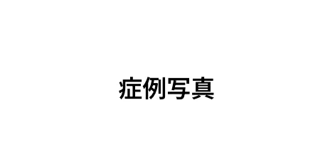 症例写真
