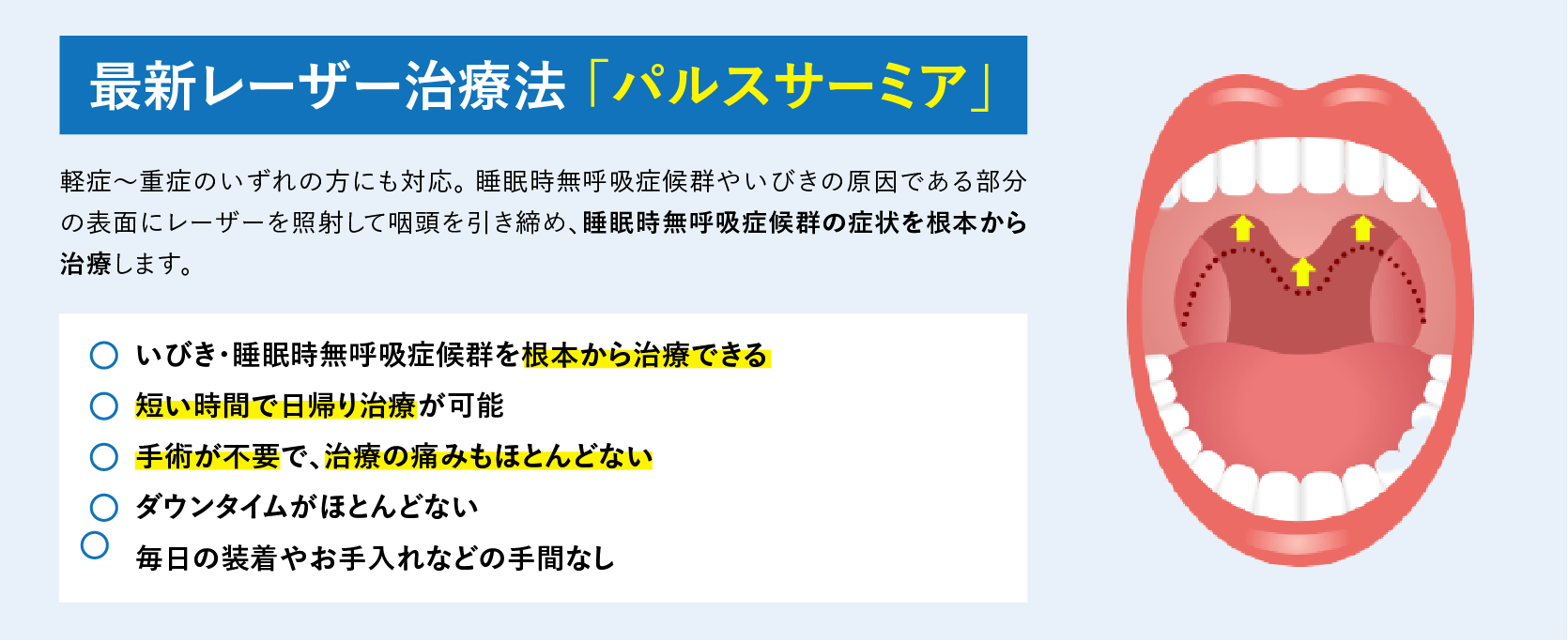 パルスサーミアの特徴