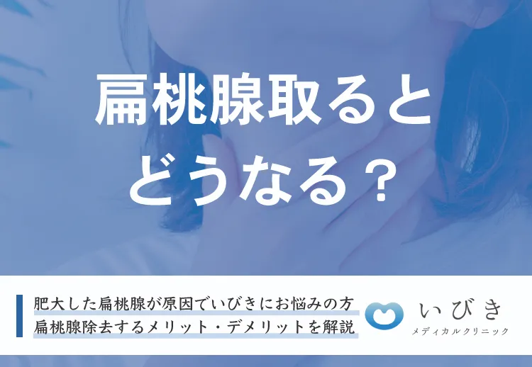 肥大した扁桃腺やアデノイドを取るメリット・デメリット！いびき治療になる？